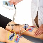 Compex DuraStick Elektrot Çıtçıtlı Yapışkan Tens Pedi 5×10 cm - Görsel 3